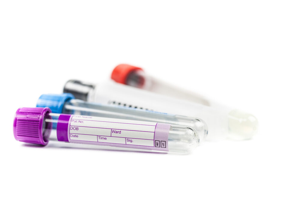 VacuumTubesForCollectingBloodSamplesInTheLab